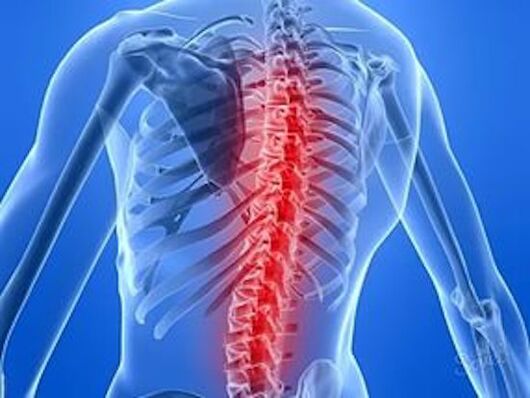 choroba kręgosłupa powoduje ból pleców