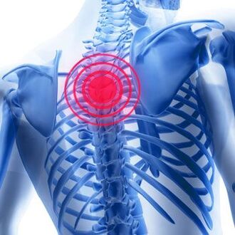 ból w klatce piersiowej z osteochondrozą klatki piersiowej